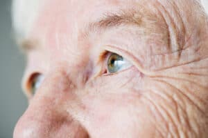 types of laser eye surgery