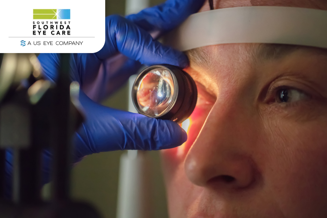 Best Time of Year for Cataract Surgery Inner Image